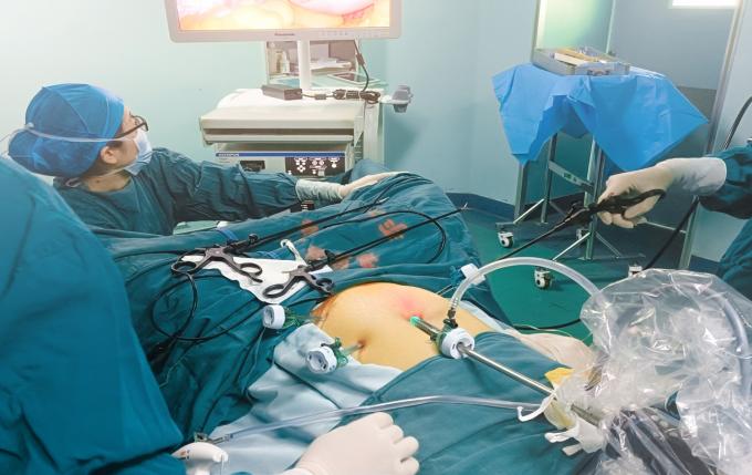 Trocar óptico y cánula desechables estériles para cirugía laparoscópica 6